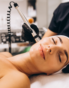 LASEROWE ZAMYKANIE NACZYNEK